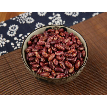 Kidney Beans Good For Kidneys